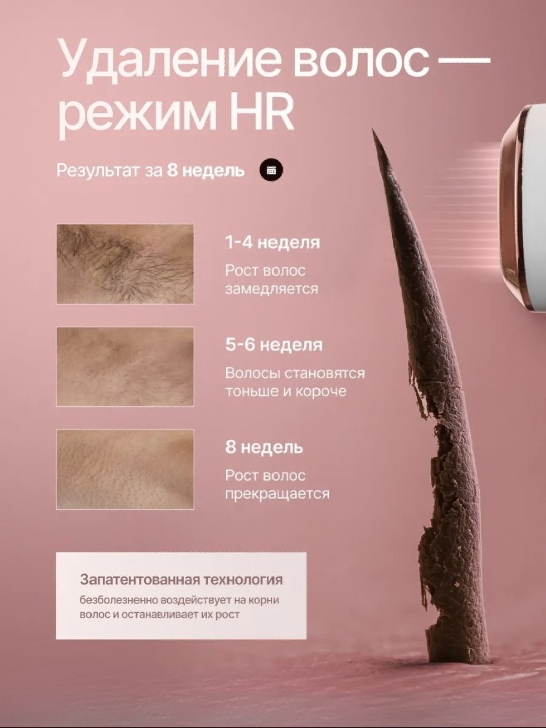 Фотоэпилятор с охлаждающей насадкой LARKO Pro Laser Hair Remover — фото 5