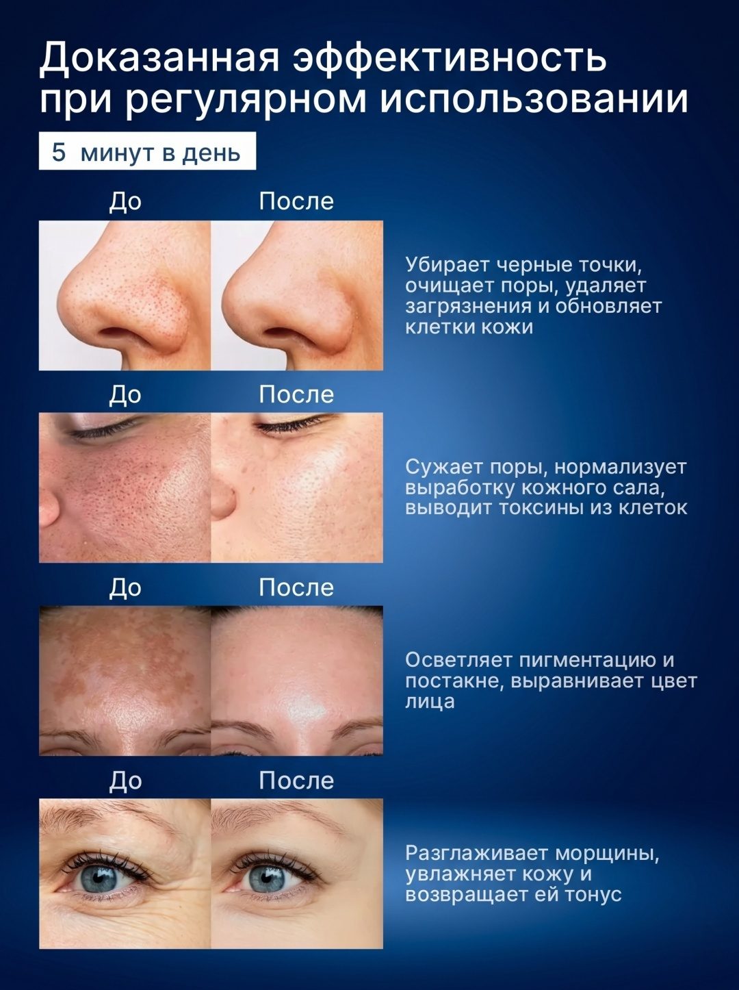 Аппарат для ультразвуковой чистки лица LARKO 18 в 1 — фото 2
