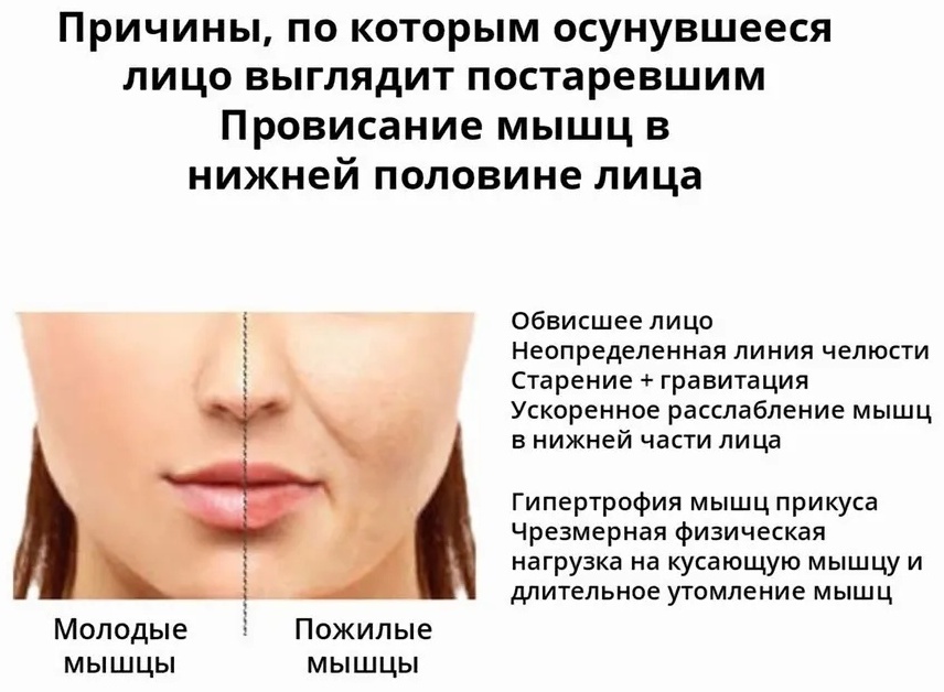 Маска для лица с EMS-лифтингом LARKO — фото 8