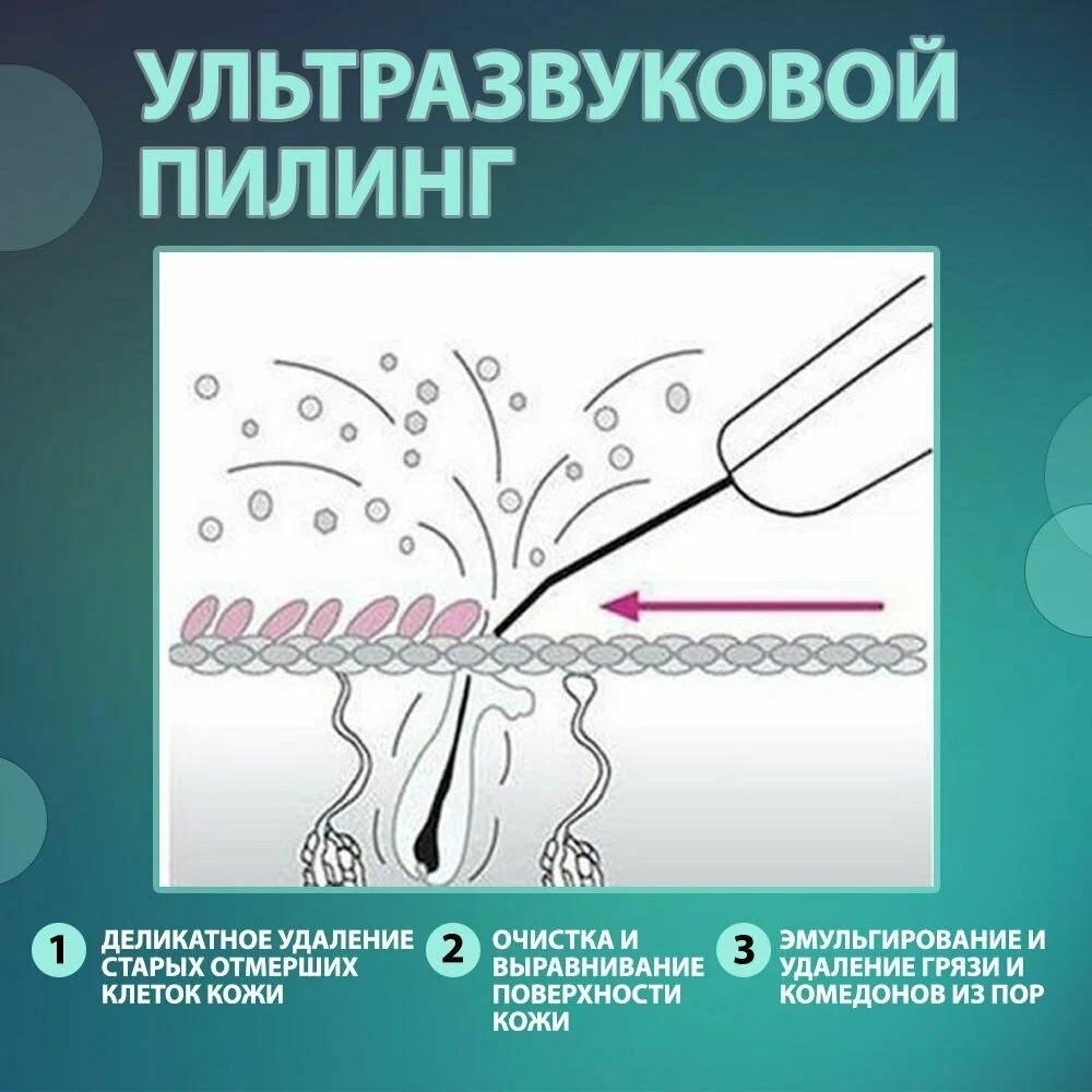 Аппарат для ультразвуковой чистки лица LARKO 18 в 1 — фото 7
